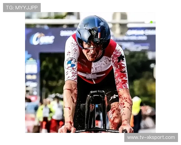 成都自行车赛伤员治疗进展鼓舞人心，2021年成都自行车比赛